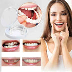 Prótesis dental de clip | Diseño que se apoya en los dientes, sin adhesivo | Para una sonrisa radiante sin visita al den
